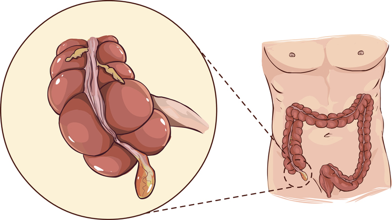 Apéndice - representación anatómica al principio del colon