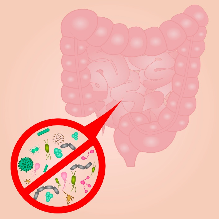 Sobrecrecimiento bacteriano del intestino delgado (SIBO)