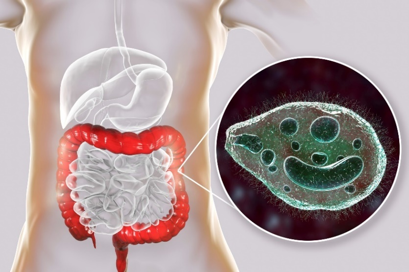 Balantidium coli - parásito que infecta el intestino grueso del tubo digestivo humano