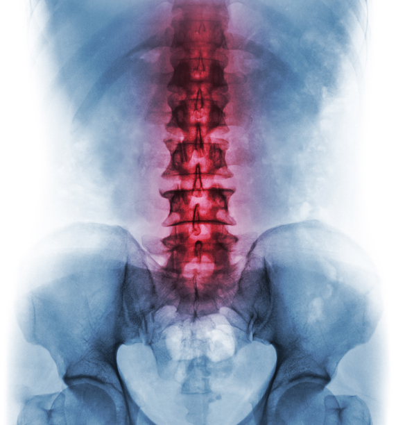 Modelo de columna vertebral y parte inferior resaltada