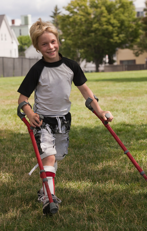 Un niño con parálisis cerebral y una prótesis para caminar. 