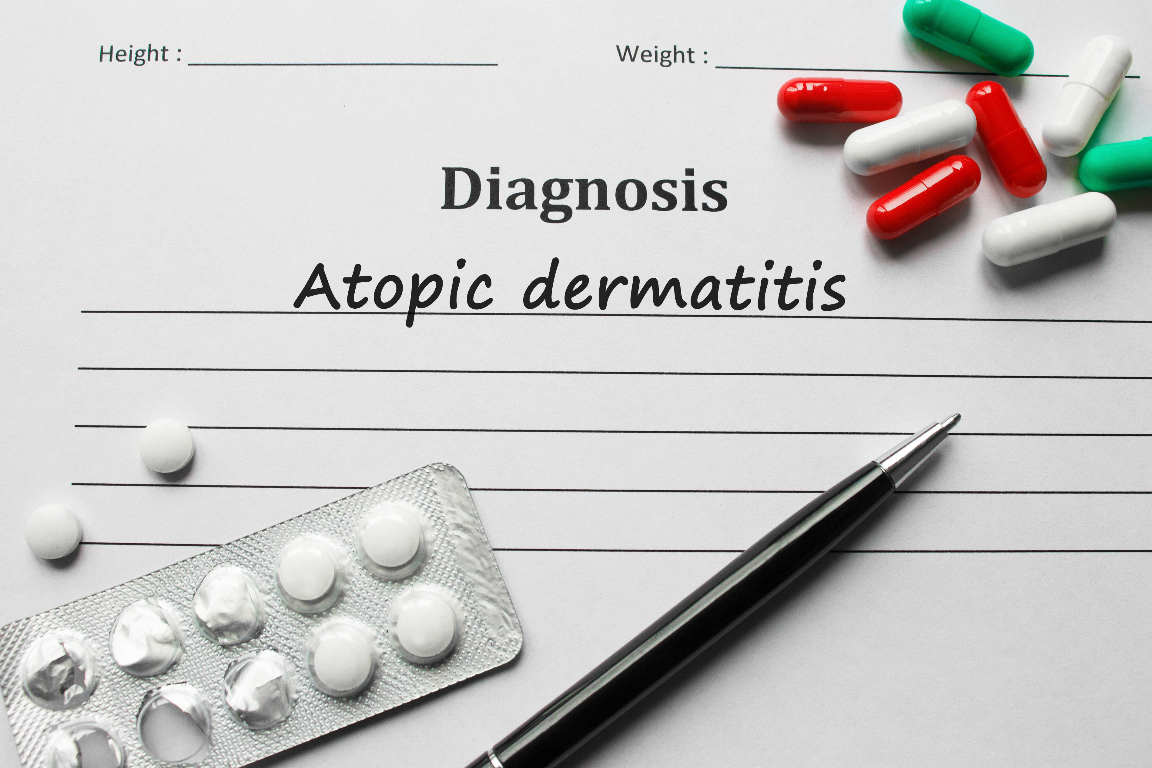 Diagnóstico de la dermatitis atópica