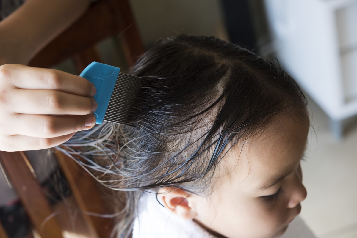 Una niña con el pelo lavado y peinándose contra los piojos con un peine especial diseñado para este fin.