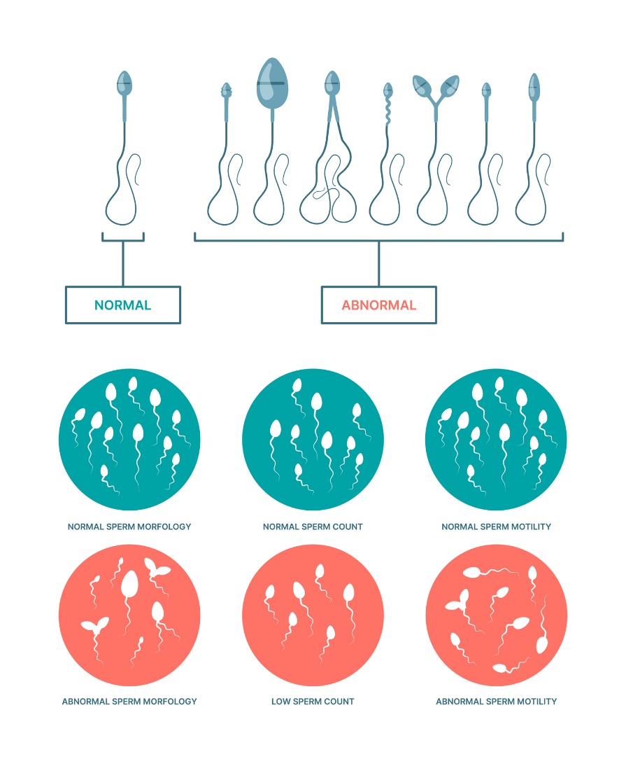 Estado fisiológico y anormal de los espermatozoides. Morfología, número y motilidad de los espermatozoides.