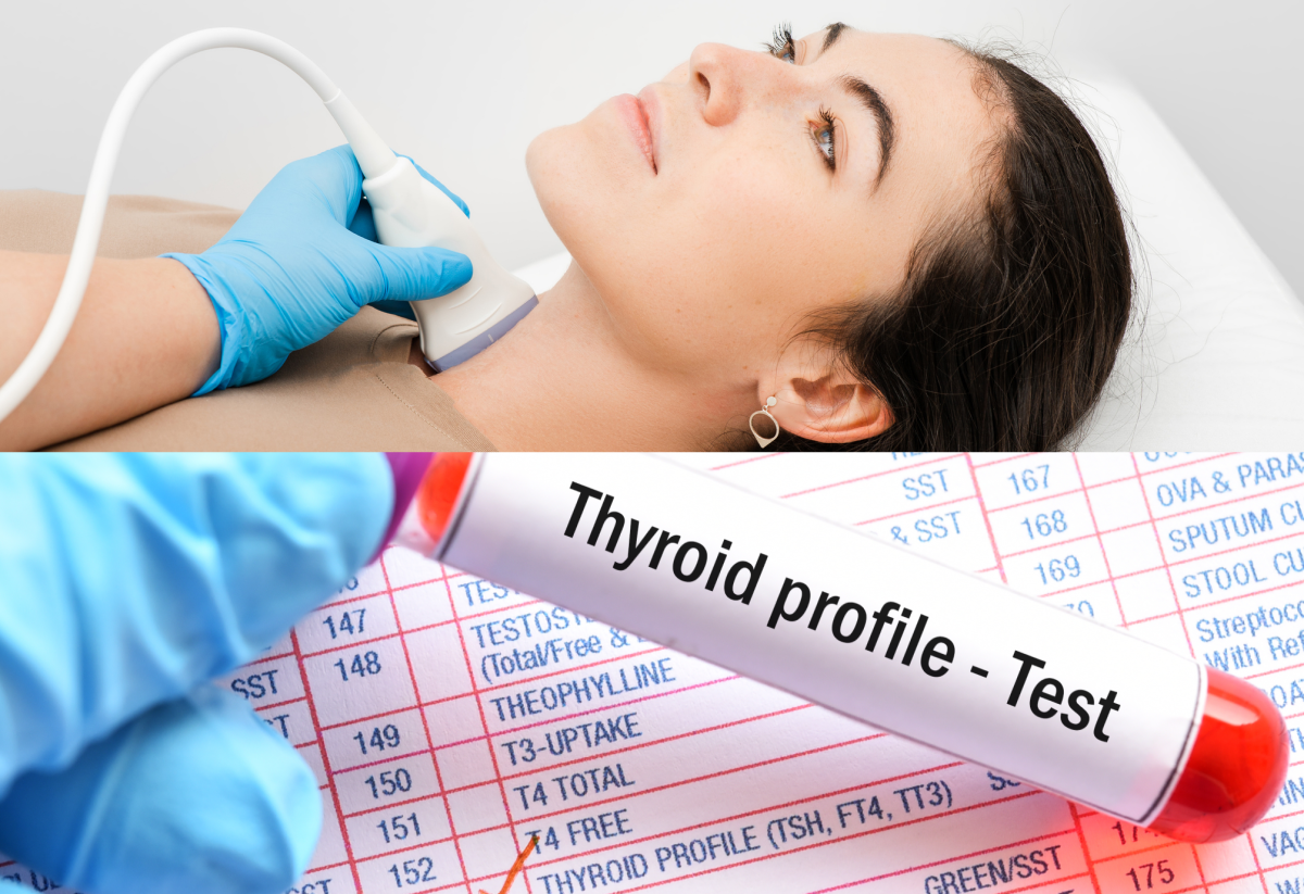 Examen del tiroides: toma de muestras de sangre y niveles hormonales y SONO/USG