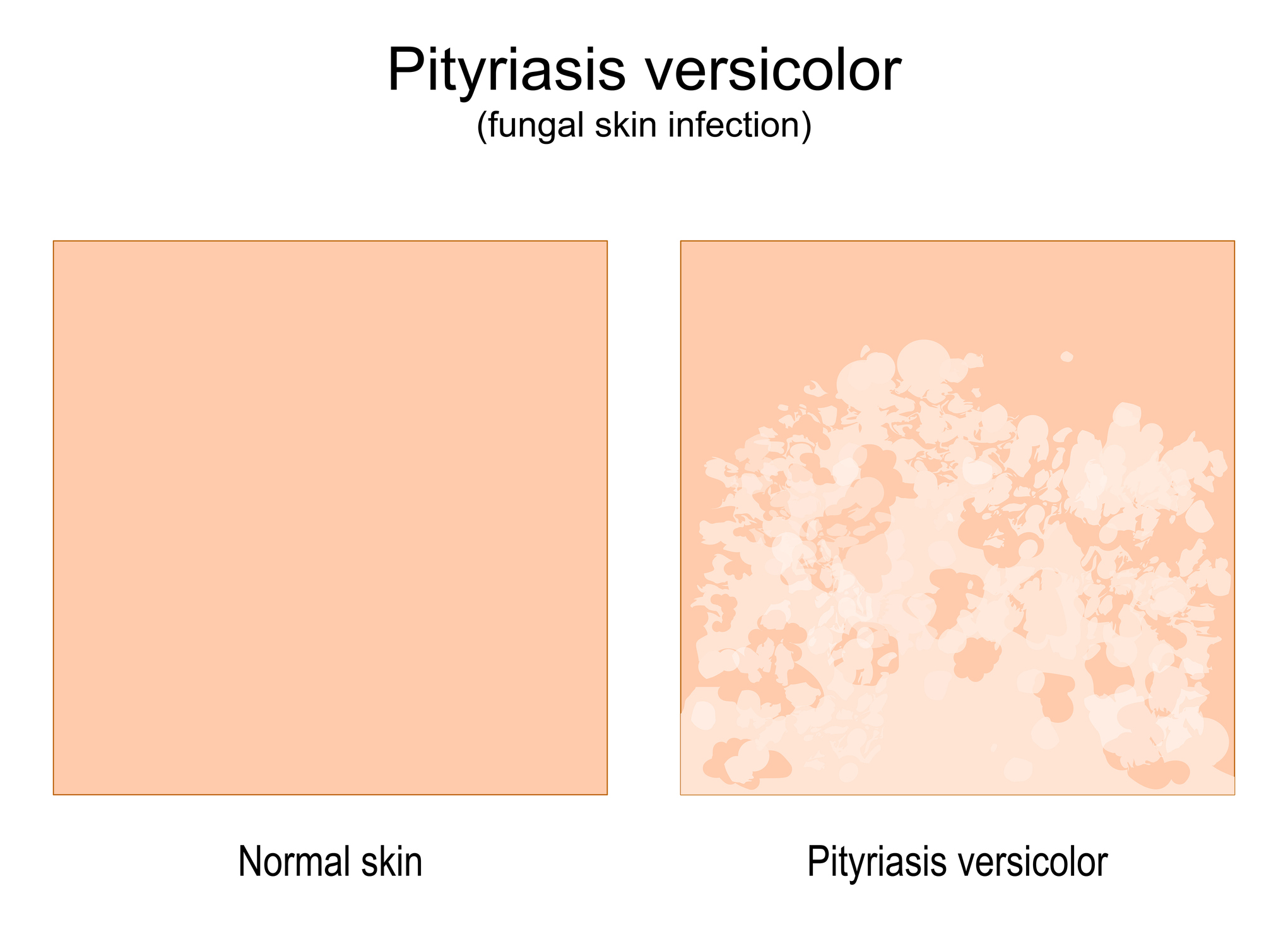 Comparación de piel normal y piel con signos de enfermedad