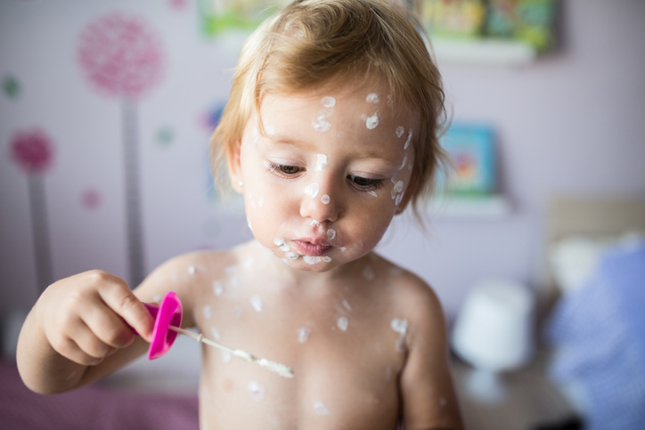 Una niña tiene un caso leve de varicela - juega con un soplador de burbujas