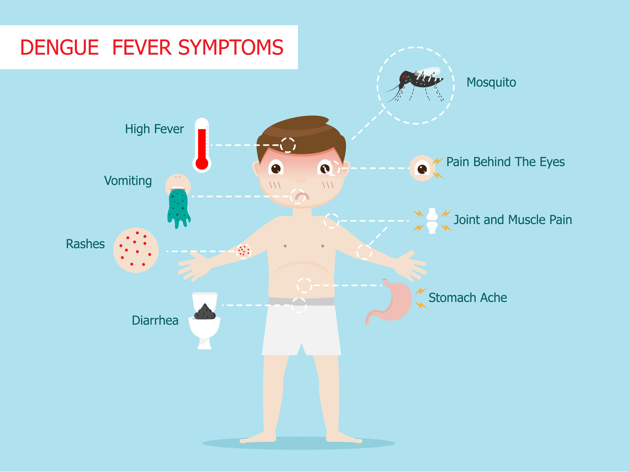 Síntomas del dengue