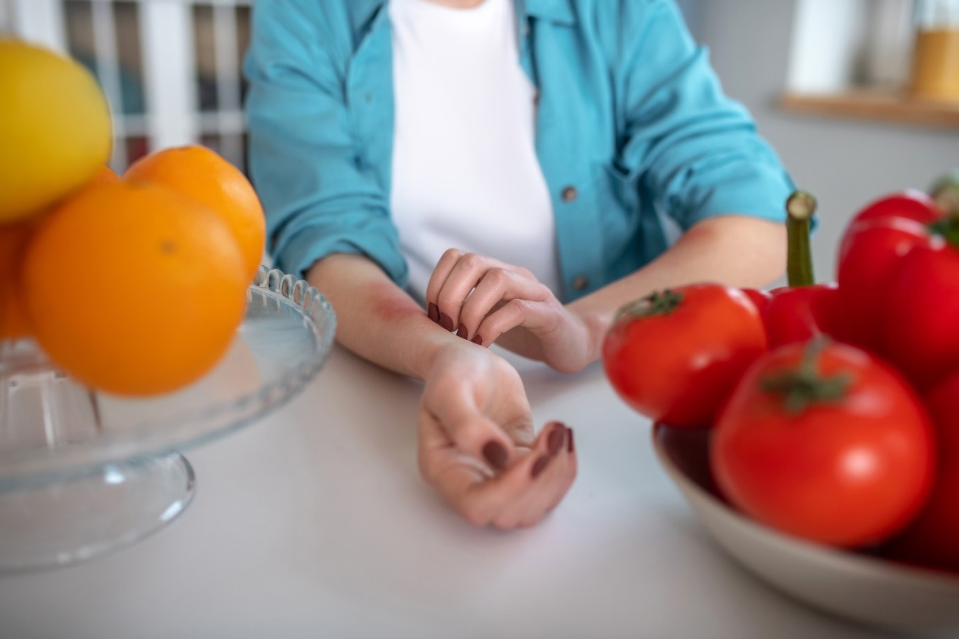 Una mujer tiene urticaria después de comer fruta o verdura. Se rasca el antebrazo.