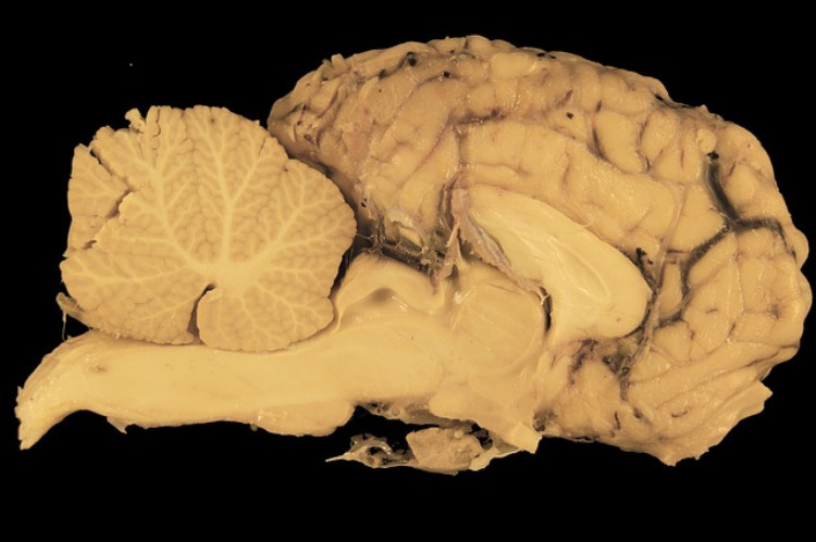 sección transversal de tejido cerebral