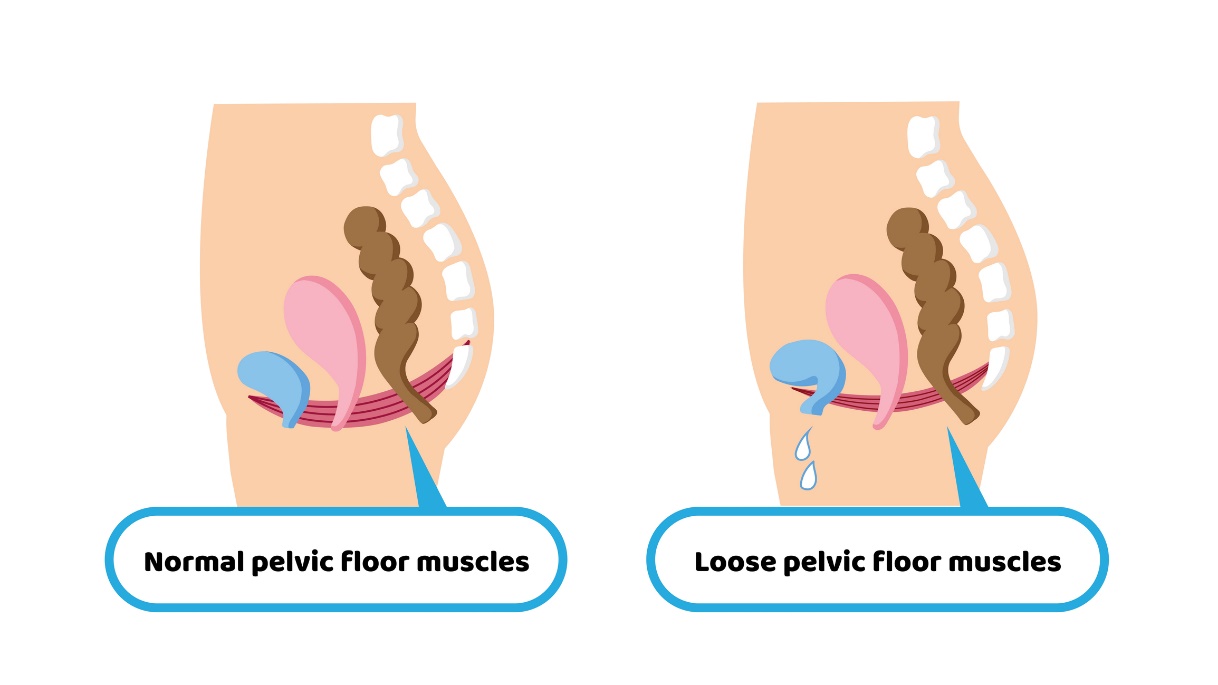 Fisiología y debilidad de la musculatura del suelo pélvico