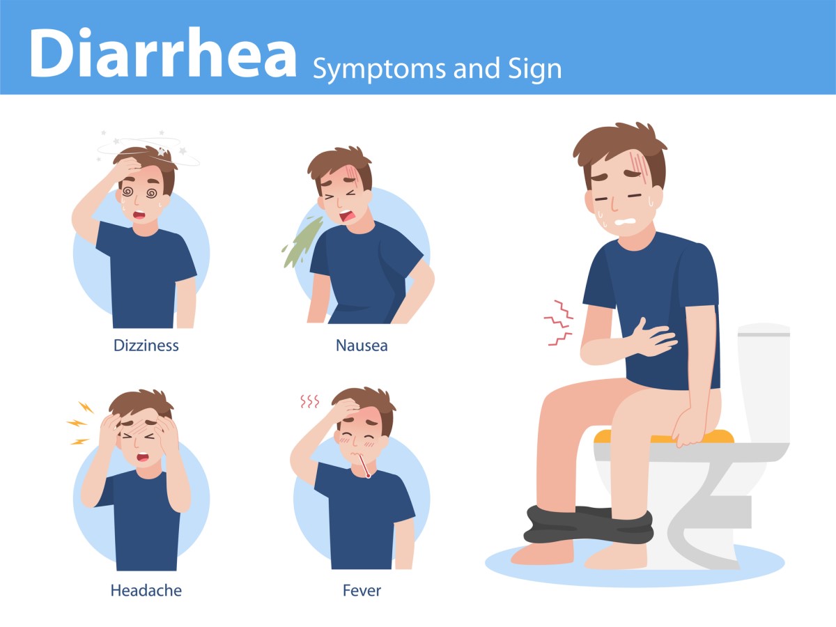 diarrea y posibles síntomas asociados: mareos (náuseas, vómitos), dolor de cabeza (cefalea), fiebre (aumento de la temperatura corporal), calambres y dolor abdominal.