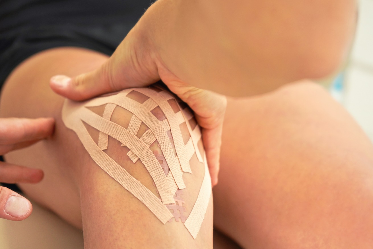 Kinesiotaping linfático (lymphotape) aplicado en la zona de la articulación de la rodilla