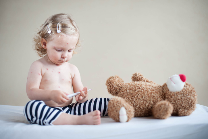 un niño con sarampión juega con un osito de peluche