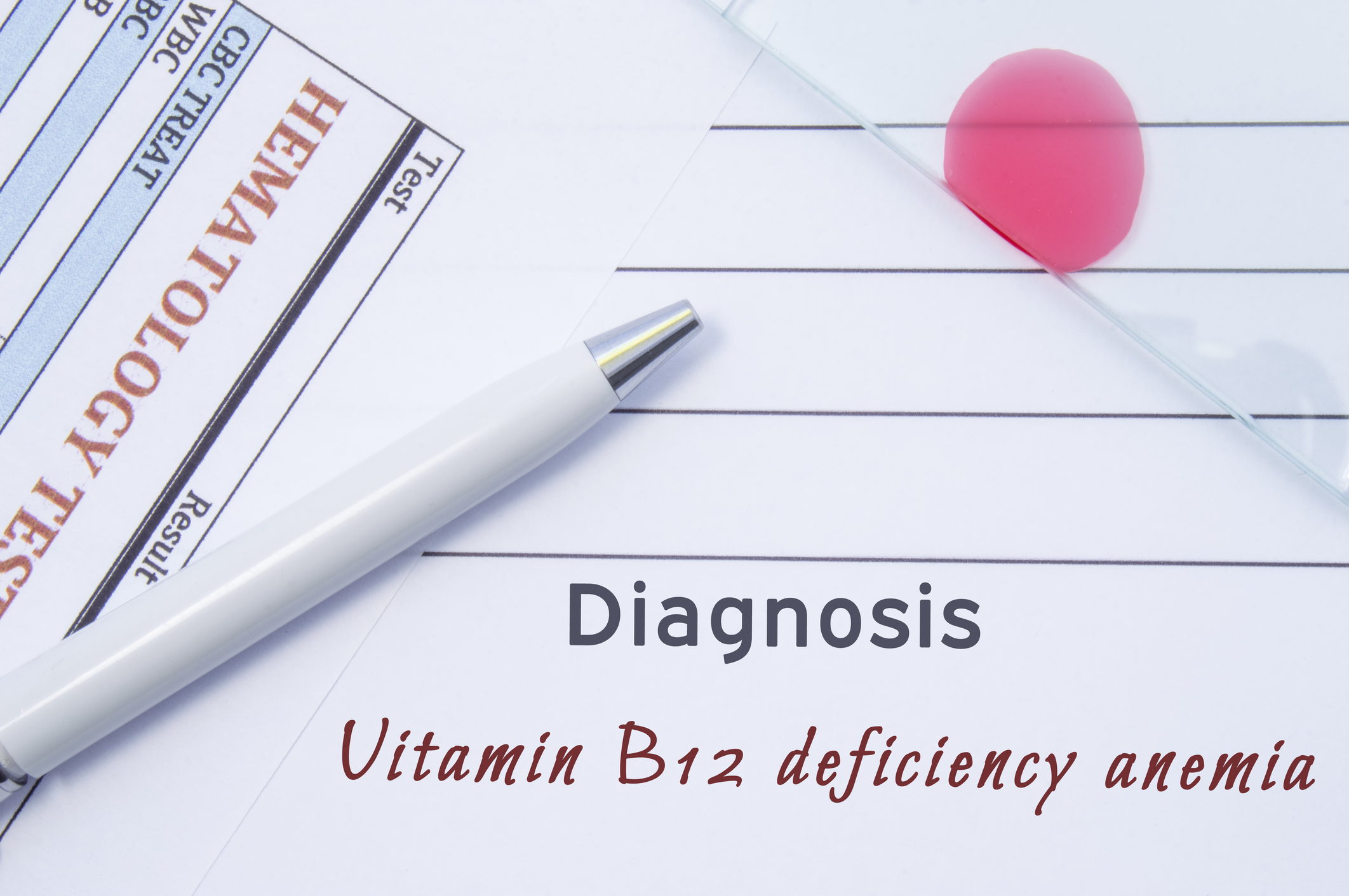 La carencia de vitamina B12 puede causar anemia perniciosa.