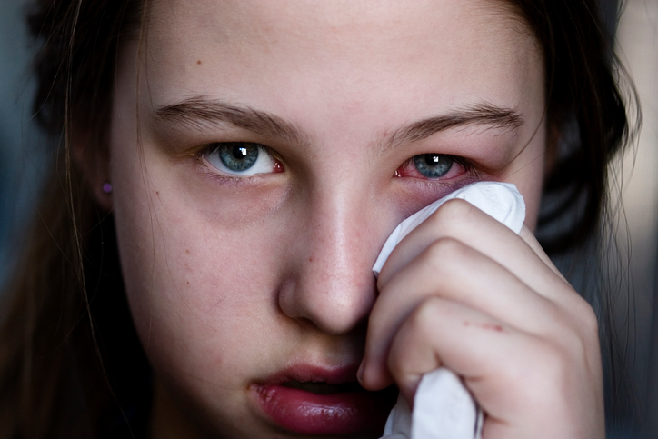 niña tiene inflamación ocular, hinchazón ocular, enrojecimiento ocular, mano, pañuelo