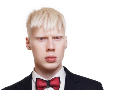 hombre albino joven, pelo blanco, con chaqueta