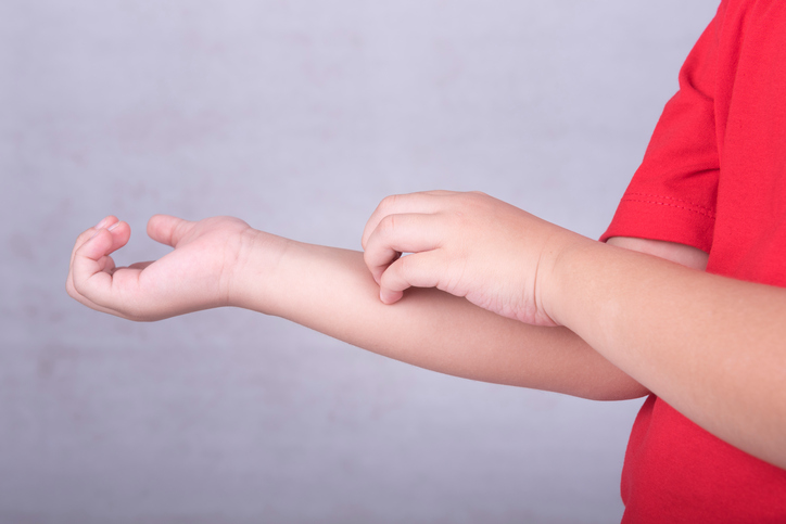 El bebé se pica el antebrazo, se rasca el antebrazo