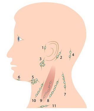 Nódulos de la cabeza y el cuello