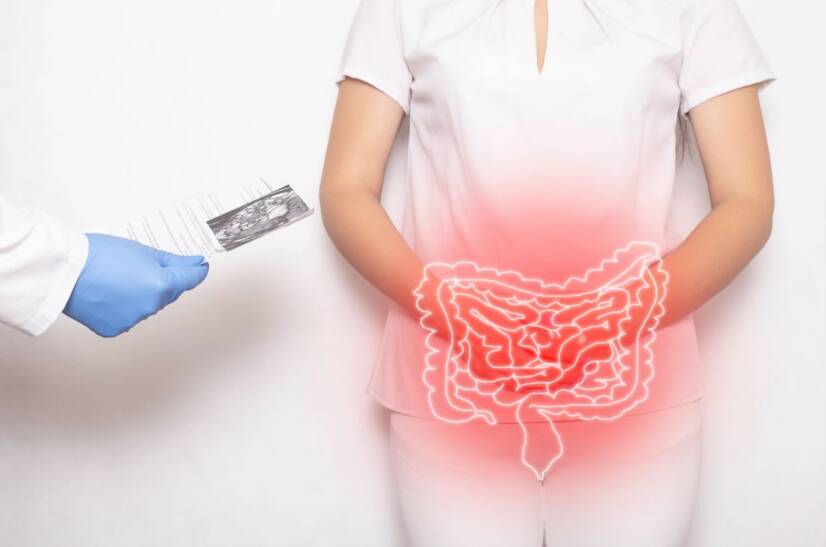 Enfermedad de Crohn: ¿qué es, por qué se produce y cuáles son sus síntomas?