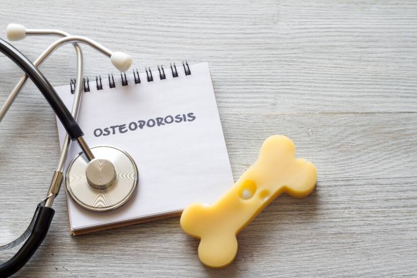 OSTEOPOROSIS: Cuando los huesos se debilitan y el tratamiento es difícil. ¿Cuáles son las causas, los síntomas y las consecuencias + consejos para prevenirla?