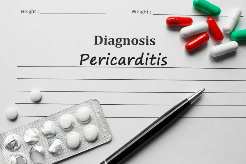 Pericarditis: inflamación del revestimiento del corazón. ¿Cuáles son sus causas y síntomas?