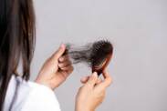 Alopecia (disminución de la cantidad de cabello): ¿cuáles son sus causas y síntomas?