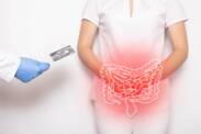 Enfermedad de Crohn: ¿qué es, por qué se produce y cuáles son sus síntomas?