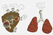 Hipertensión pulmonar: qué es y por qué se produce + Síntomas y tratamiento