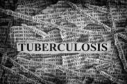 La tuberculosis no es cosa del pasado, mata a millones de personas cada año